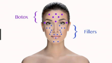 LE INDICAZIONI DI BOTOX E FILLERS - Dott. Paolo Queirazza 