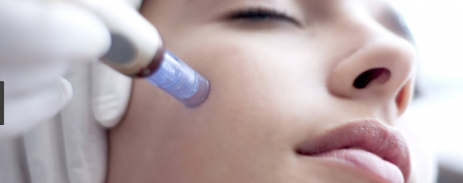 NATURAL NEEDLING - Dott. Paolo Queirazza 